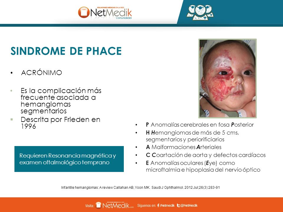 SINDROME DE PHACE PDF DOWNLOAD SINDROME DE PHACE PDF DOWNLOAD